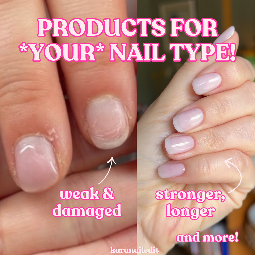 Specific Nail Products For *YOUR* Nail Type! 💅 – karanailedit