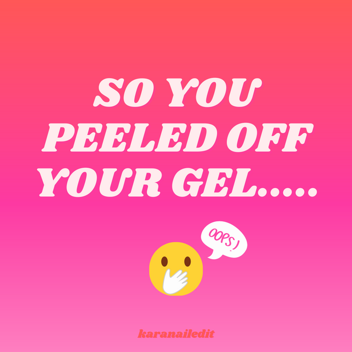 SO YOU PEELED OFF YOUR GEL.... Practical Tips To Get Your Nails Back In Shape!